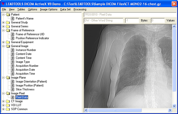 Capture d'écran de LEADTOOLS Medical SDK
